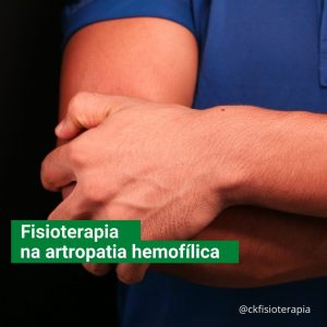 Artrose hemofílica